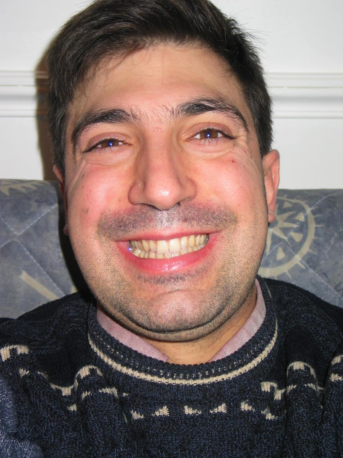 abl.jpg